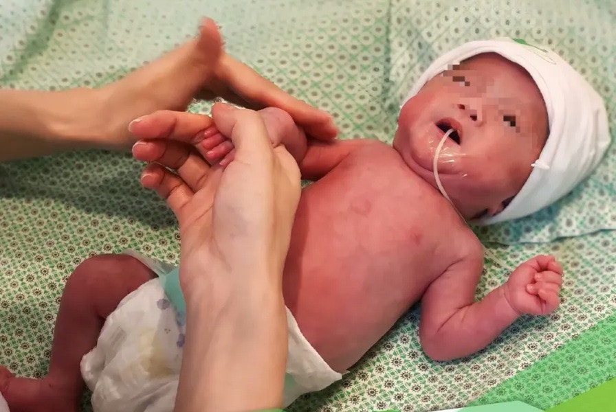 Hành trình kỳ diệu của em bé chào đời nặng 400g, lọt thỏm trong bàn tay bác sĩ