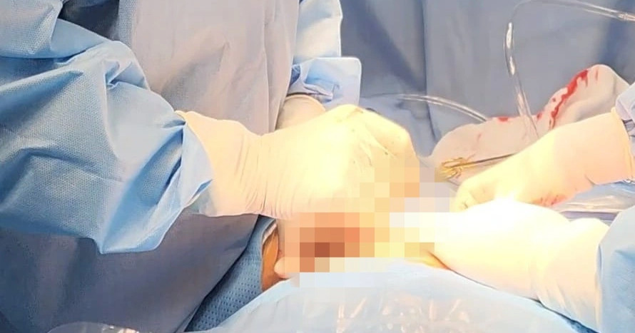 Vụ 'bệnh nhân đau ruột thừa bị cắt buồng trứng': Rất dễ chẩn đoán nhầm