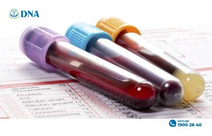 Bệnh viện Quốc tế DNA khám miễn phí công thức máu cho người dân cả nước ‏