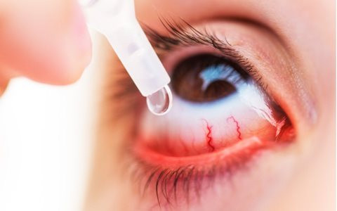 Cảnh báo tự chữa trị đau mắt đỏ tại nhà