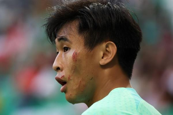Cầu thủ Trung Quốc bị đạp xước mặt, trọng tài vẫn làm ngơ