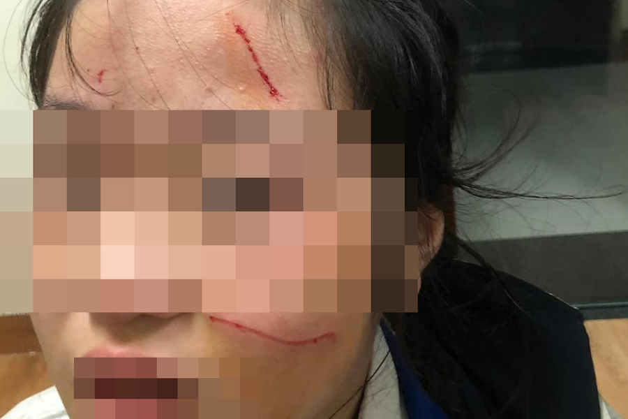 Nữ sinh Hà Nội đánh em lớp dưới chảy máu mặt bị buộc thôi học 6 ngày